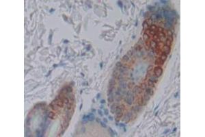 Figure. (LDLRAP1 antibody  (AA 1-308))