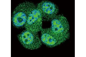 Confocal immunofluorescent analysis of AKT1 Antibody (C-term ) (ABIN655915 and ABIN2845314) with MCF-7 cell followed by Alexa Fluor 488-conjugated goat anti-rabbit lgG (green). (AKT1 antibody  (C-Term))