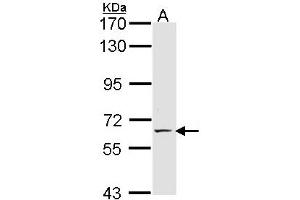 Western Blotting (WB) image for anti-Selectin E (SELE) (AA 278-506) antibody (ABIN467628) (Selectin E/CD62e antibody  (AA 278-506))
