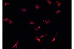ABIN6276804 staining HepG2? (TAC1 antibody  (N-Term))