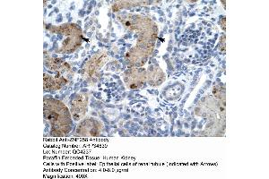 Human kidney (ZMYM6 antibody  (Middle Region))