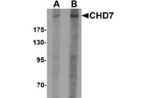 Western blot analysis of CHD7 in SK-N-SH cell lysate with CHD7 antibody at (A) 1 and (B) 2 ug/mL. (CHD7 antibody  (N-Term))