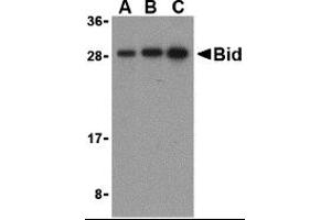 Western Blotting (WB) image for anti-BH3 Interacting Domain Death Agonist (BID) (C-Term) antibody (ABIN1030296) (BID antibody  (C-Term))