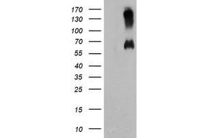 HEK293T cells were transfected with the pCMV6-ENTRY control (Left lane) or pCMV6-ENTRY C18orf8 (Right lane) cDNA for 48 hrs and lysed. (C18orf8 antibody)