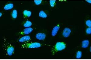 IF analysis of Ribonuclease Inhibitor/RNH1 using anti-Ribonuclease Inhibitor/RNH1 antibody (ABIN7603117).