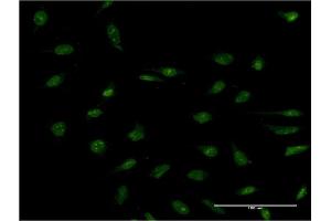 Immunofluorescence (IF) image for anti-Protein Phosphatase 2A 48 KDa Regulatory Subunit (PPP2R3B) (AA 1-225) antibody (ABIN525999)