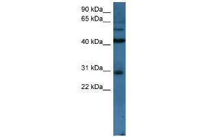 WB Suggested Anti-TLX2 Antibody Titration: 0.