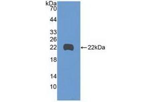 Detection of Recombinant GADD45b, Human using Polyclonal Antibody to Growth Arrest And DNA Damage Inducible Protein Beta (GADD45b) (GADD45B antibody  (AA 1-160))