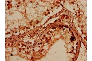 Immunohistochemistry of paraffin-embedded human testis tissue using ABIN7165083 at dilution of 1:100 (PRMT7 antibody  (AA 285-390))
