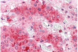 Human Adrenal: Formalin-Fixed, Paraffin-Embedded (FFPE) (COMT antibody  (C-Term))