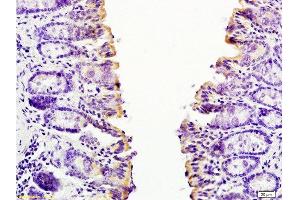 Immunohistochemistry (Paraffin-embedded Sections) (IHC (p)) image for anti-Chemokine (C-C Motif) Ligand 24 (CCL24) (AA 27-119) antibody (ABIN740925)