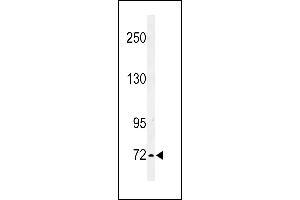 IL1RAPL2 抗体  (AA 372-401)