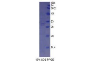 SDS-PAGE analysis of Mouse ABCA1 Protein. (ABCA1 Protein)