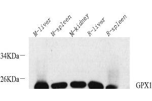 Western Blot analysis of various samples using GPX1 Polyclonal Antibody at dilution of 1:1000. (Glutathione Peroxidase 1 antibody)