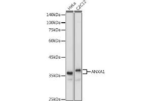 Western blot analysis of extracts of various cell lines, using  antibody (ABIN6133581 and ABIN6136917) at 1:1000 dilution. (Annexin a1 antibody)
