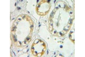#VALUE! (TREH antibody  (AA 237-420))