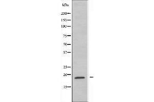RPL12 anticorps  (C-Term)