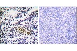 Immunohistochemistry analysis of paraffin-embedded human tonsil tissue, using NYREN18 Antibody. (NUB1 antibody  (AA 566-615))