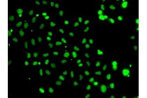 Immunofluorescence analysis of A-549 cells using HMG20A antibody (ABIN6130458, ABIN6141856, ABIN6141857 and ABIN6223115).