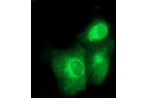 Image no. 2 for anti-Bone Morphogenetic Protein 1 (BMP1) (AA 225-617) antibody (ABIN1491232) (BMP1 antibody  (AA 225-617))