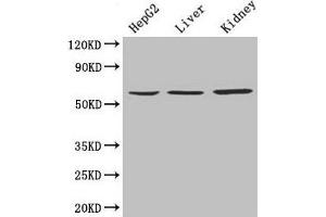Western Blot Positive WB detected in: HepG2 whole cell lysate, Mouse liver tissue, Mouse kidney tissue All lanes: NAPRT antibody at 4 μg/mL Secondary Goat polyclonal to rabbit IgG at 1/10000 dilution Predicted band size: 58, 61, 57 kDa Observed band size: 58 kDa (NAPRT1 antibody  (AA 1-310))