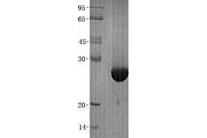 Validation with Western Blot (TPI1 Protein (His tag))