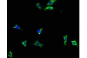 Immunofluorescence staining of SH-SY5Y cells with ABIN7140040 at 1:133, counter-stained with DAPI. (INPP5F antibody  (AA 187-204))