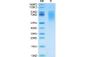MUC16 Protein (AA 12660-12923) (His-Avi Tag)