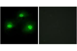 Immunofluorescence analysis of HeLa cells, using IPKA Antibody. (PKIA antibody  (AA 10-59))