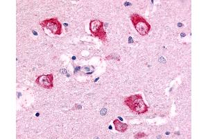 Anti-PAK7 antibody IHC of human brain, thalamus neurons. (PAK7 antibody  (Internal Region))