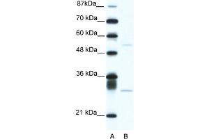 WB Suggested Anti-ATF4 Antibody Titration:  5. (ATF4 antibody  (C-Term))