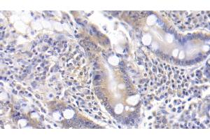Detection of TFPI in Human Small intestine Tissue using Polyclonal Antibody to Tissue Factor Pathway Inhibitor (TFPI) (TFPI antibody  (AA 29-210))