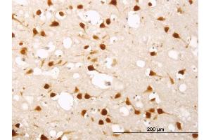 Immunostaining (ISt) image for anti-ELAV (Embryonic Lethal, Abnormal Vision, Drosophila)-Like 4 (Hu Antigen D) (ELAVL4) (AA 312-380) antibody (ABIN560727)