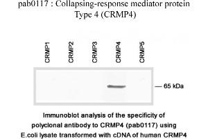 Image no. 2 for anti-Dihydropyrimidinase-Like 3 (DPYSL3) (C-Term) antibody (ABIN347041)