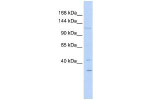 WWP1 antibody used at 1 ug/ml to detect target protein. (WWP1 antibody  (N-Term))