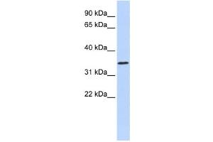 Western Blotting (WB) image for anti-Zinc Finger Protein 660 (ZNF660) antibody (ABIN2458227)