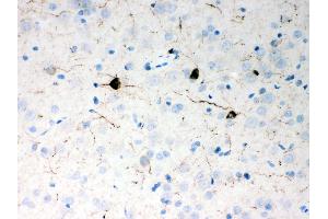 Anti- Neuropeptide Y Picoband antibody,IHC(P) IHC(P): Rat Brain Tissue (NPY antibody  (Middle Region))