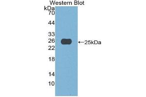 Western Blotting (WB) image for anti-APOBEC1 Complementation Factor (A1CF) (AA 389-587) antibody (ABIN1980366)