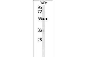 C4B Antibody (C-term) (ABIN652149 and ABIN2840567) western blot analysis in WiDr cell line lysates (35 μg/lane). (C4BPA antibody  (C-Term))