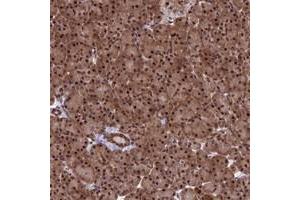 Immunohistochemical staining of human pancreas with C14orf166 polyclonal antibody  shows strong nuclear and cytoplasmic positivity in exocrine glandular cells at 1:200-1:500 dilution.
