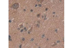 IHC-P analysis of Human Tissue, with DAB staining. (BCL11A antibody  (AA 1-210))