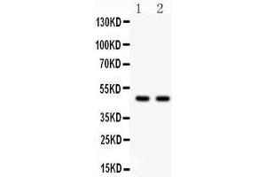 Observed bind size: 47KD (PTOV1 antibody  (C-Term))