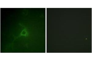 Immunofluorescence analysis of COS7 cells, using GFAP (Ab-38) Antibody. (GFAP antibody  (AA 11-60))