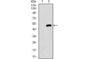 Western blot analysis using EGFR mutant mAb against HEK293 (1) and EGFR mutant (AA: 693-893)-hIgGFc transfected HEK293 (2) cell lysate. (EGFR Mutant (AA 693-893), (Mutant) antibody)