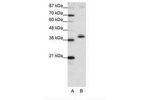 Image no. 1 for anti-Zinc Finger Protein 25 (ZNF25) (C-Term) antibody (ABIN203079)