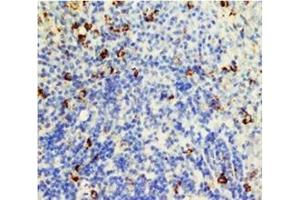 Paraffin Rat Spleen tissue lysate stained with CD95 / FAS (FAS antibody  (N-Term))