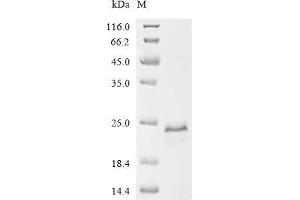 (Tris-Glycine gel) Discontinuous SDS-PAGE (reduced) with 5 % enrichment gel and 15 % separation gel.