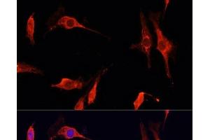 Immunofluorescence analysis of C6 cells using DNASE1 Polyclonal Antibody at dilution of 1:100 (40x lens). (DNASE1 antibody)