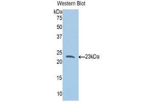 Western Blotting (WB) image for anti-Slit Homolog 1 (SLIT1) (AA 647-835) antibody (ABIN3204490) (SLIT1 antibody  (AA 647-835))