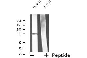 Western blot analysis of extracts from Jurkat cells, using ATG16L1 antibody. (ATG16L1 antibody  (C-Term))